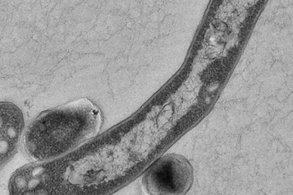 Tuberkulose wird mit Antibiotika behandelt.