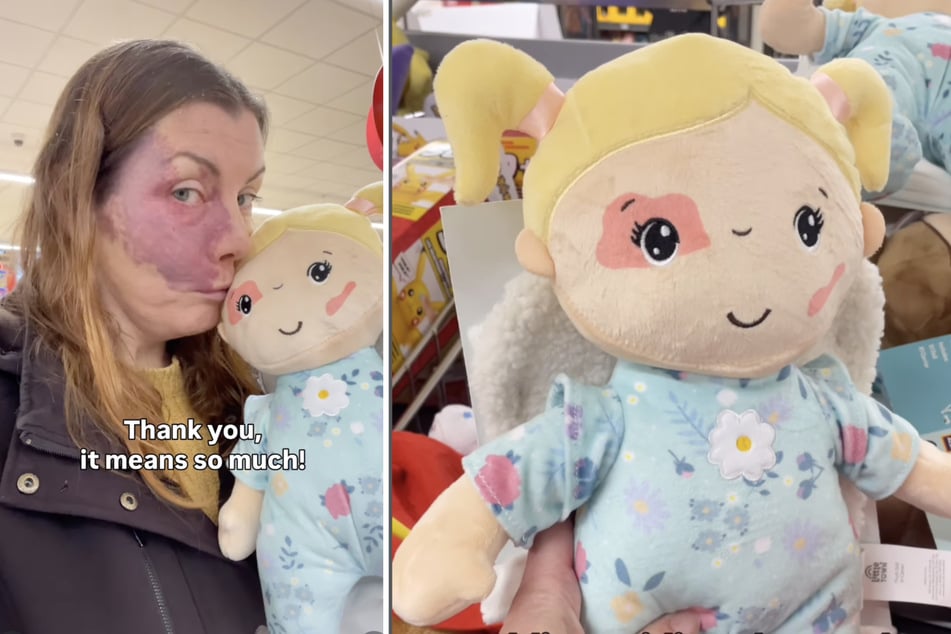 Dank der medialen Aufmerksamkeit, welche die bekritzelte Puppe auslöste, konnte die Schottin ein Unternehmen gewinnen, das nun Spielzeug mit Muttermalen herstellt.