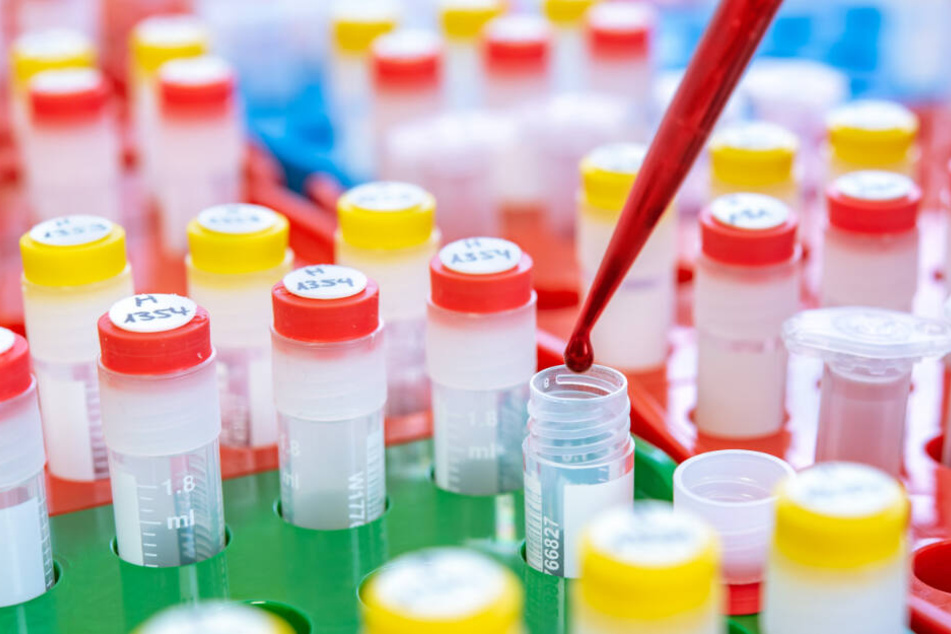 Die Uniklinik in Heidelberg ist zuletzt wegen eines umstrittenen Bluttests zur Erkennung von Brustkrebs in die Schlagzeilen geraten.