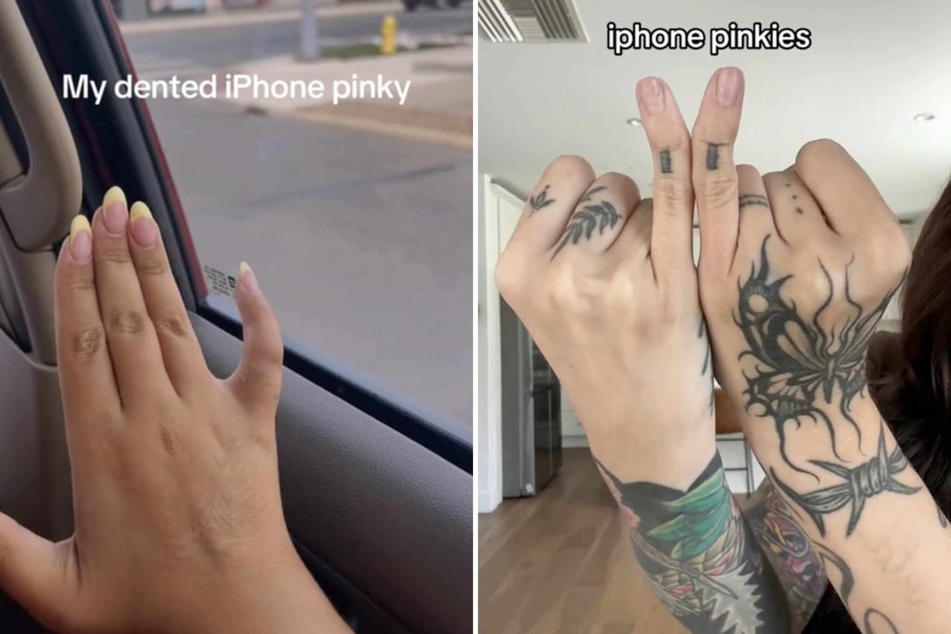 What is the iPhone pinky? TikTokers compare notes on hand deformity caused by cell phone use