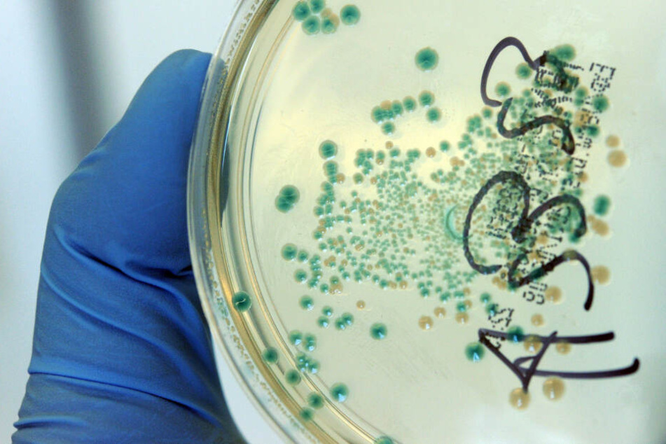 Eine Agar-Schale mit E.coli-Bakterien.