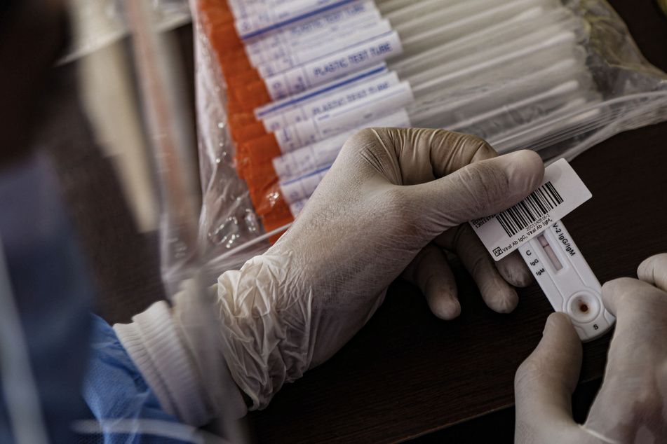 Ein medizinischer Mitarbeiter hält einen Test neben Abstrichproben. (Archivbild)