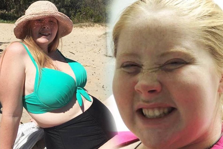 Keely Dellit (23) bevor sie 57 Kilogramm abnahm.