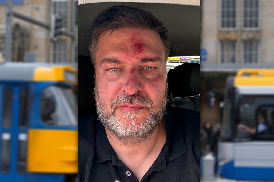 Mit heftigen Blessuren im Gesicht zeigte sich Volker Klostermann (52) am Sonntag auf Facebook. Der CDU-Landtagskandidat ist am Samstag in Leipzig Opfer eines Angriffs geworden.