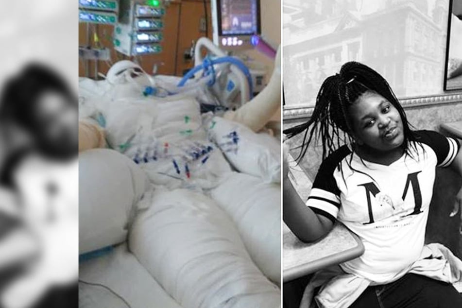 Timiyah (12) überlebte mit schwerten Verbrennungen.
