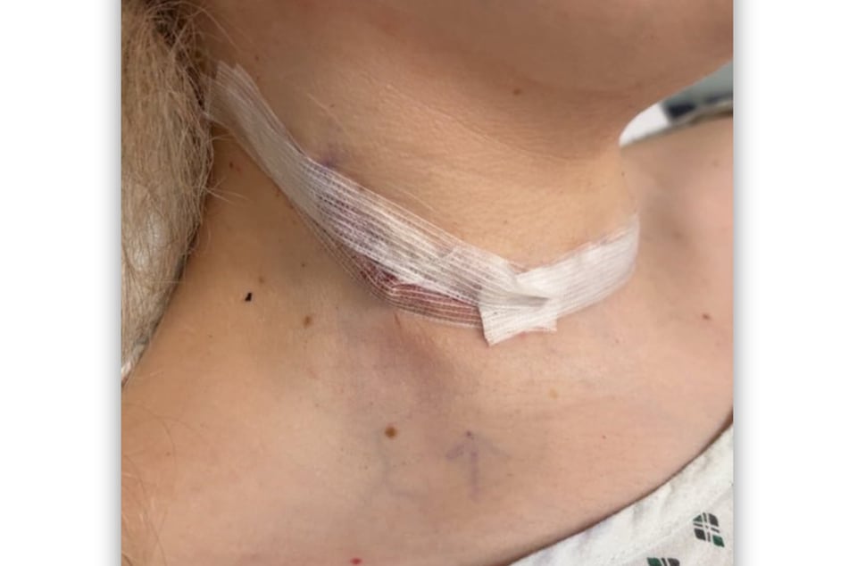 Im Dezember wurde der Tumor operativ entfernt.