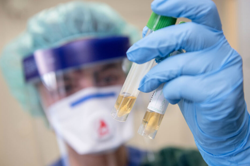 Eine Krankenschwester auf der Infektionsstation der Uniklinik Essen betrachtet in Schutzkleidung und mit einer Atemmaske zwei Abstrichröhrchen.