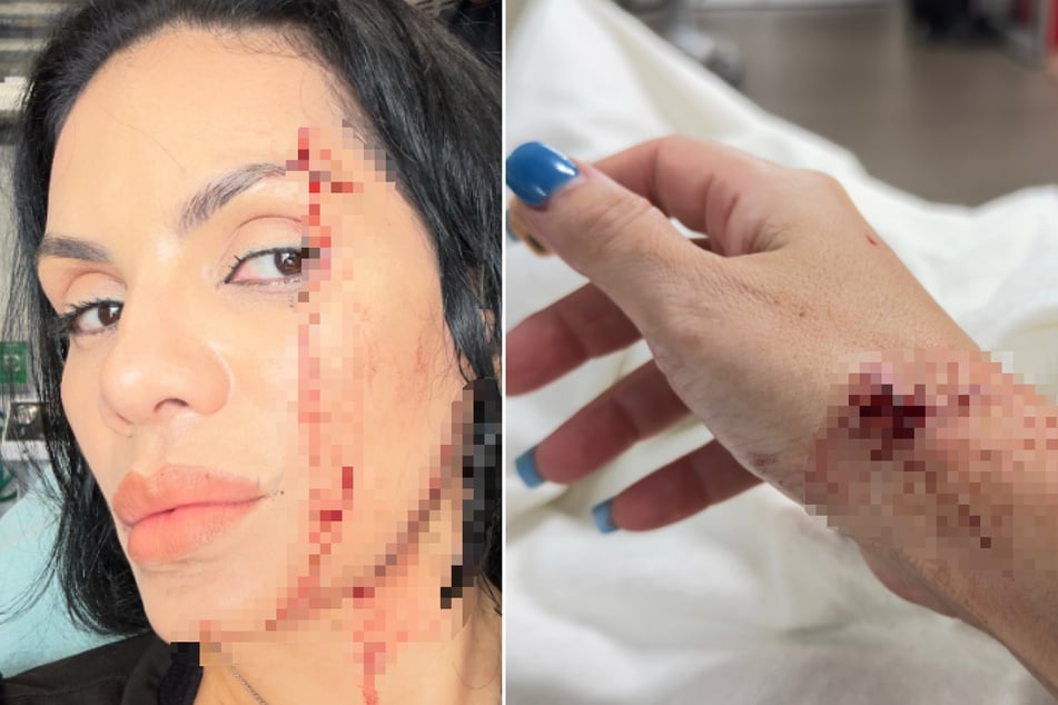 Beide Influencer wurden bei dem Unfall leicht verletzt.