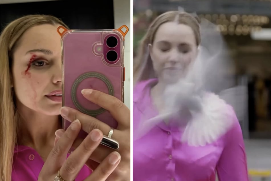 "Du blutest!": Reporterin vor laufender Kamera von Möwe getroffen