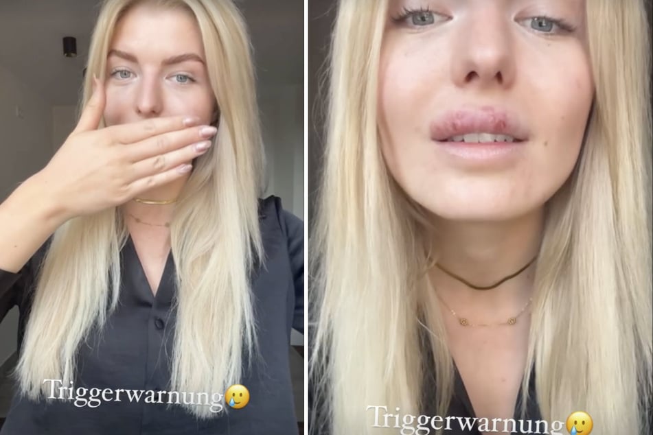 Antonia Hemmer (24) sprach eine "Triggerwarnung" für ihre Fans aus.