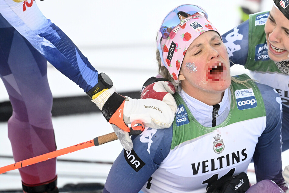 Blutige Szenen im Langlauf: Drama um US-Skistar Jessie Diggins!