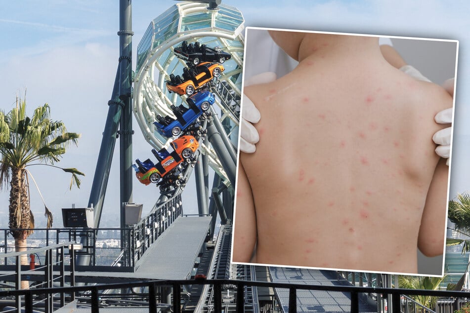 Masern-Alarm im Freizeitpark: Infizierter Besucher sorgt elf Stunden für Gefahr