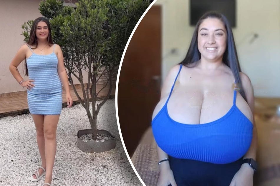 Thaynara Marcondes (22 ans) a subi une transformation remarquable en quelques mois à peine. La jeune femme s'est retrouvée avec une poitrine exceptionnellement développée.