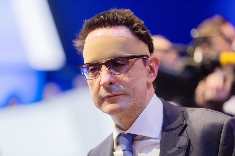 Der Säureanschlag auf Bernhard Günther (54), damaliger Finanzvorstand von Innogy, ist auch nach drei Jahren noch nicht aufgeklärt.
