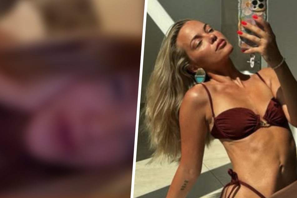 Laura Maria Rypa zeigt sich nach Beauty-Eingriff im Gesicht: "Ich find', ich wirke jünger"