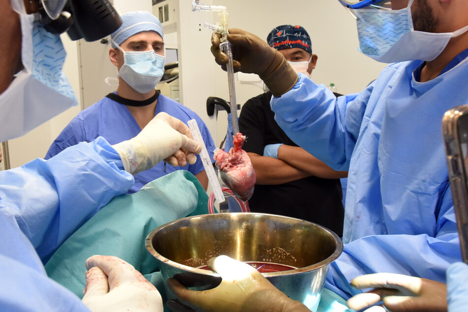 Eine herkömmliche Herztransplantation kam für Lawrence Faucette (†58) aufgrund seines fortgeschrittenen Krankheitszustands nicht infrage.