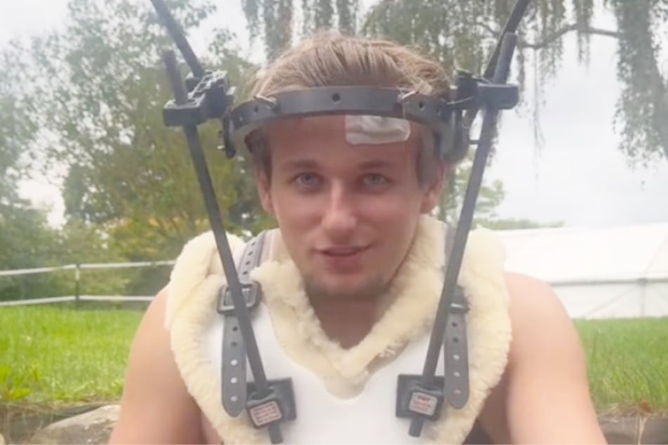 Nach seinem Genickbruch musste Amateurfußballer Max Dettmann (19) monatelang mit einem sperrigen Kopfgestell herumlaufen.