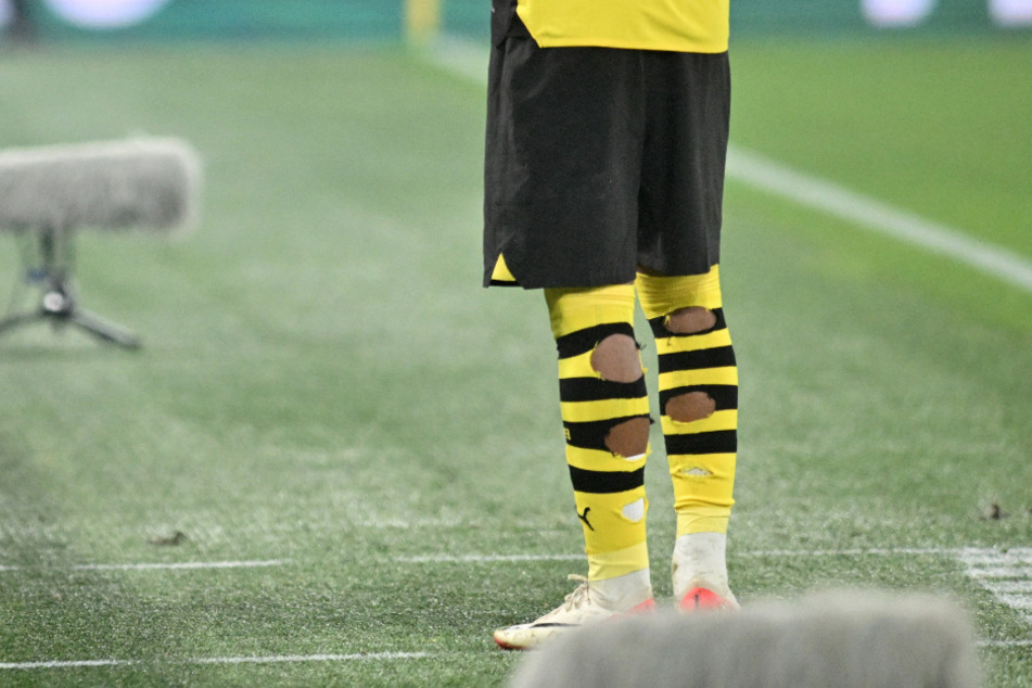 Donyell Malen (24) geht für Borussia Dortmund regelmäßig mit vier Löchern in den Strümpfen auf Torejagd.