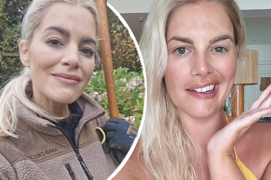 Heute (l.) hat sich die halbseitige Gesichtslähmung von Angelina Kirsch (37) im Vergleich zu vor zwei Jahren (r.) deutlich gebessert. Ganz verschwunden ist sie aber noch nicht.