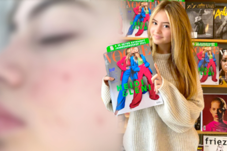 Auf Instagram zeigt sich Leni Klum (16) ganz natürlich.