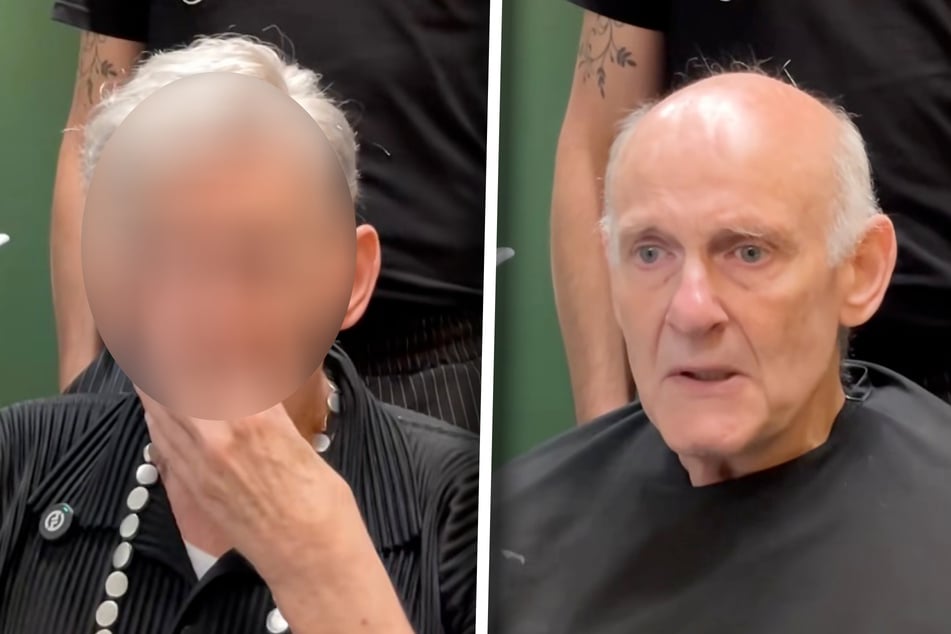 Un homme souffre énormément de sa calvitie : ce que le spécialiste capillaire lui fait le coupe le souffle.