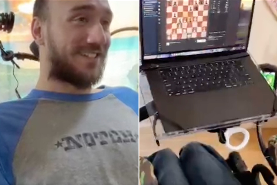 Noland Arbaugh plays chess with the help of a Neuralink brain implant in a new video shared to X.