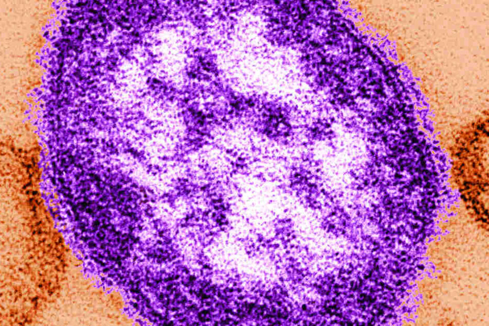 Eine Abbildung, die mit Hilfe eines Transmissionselektronenmikroskops gemacht wurde, zeigt Teile eines Masernvirus.