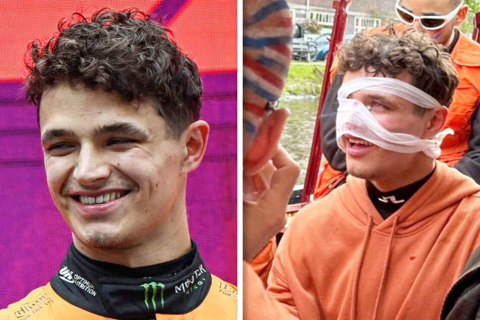 Was ist denn da passiert? Formel-1-Star schockt Fans mit blutigem Verband im Gesicht!
