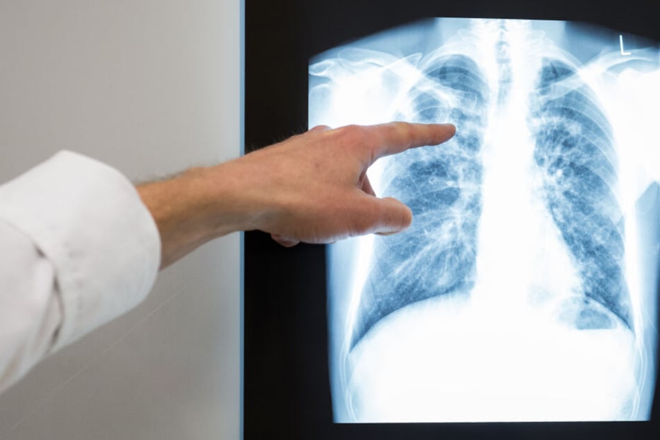 Röntgenbilder und ähnlich sensible Patientendaten waren im Internet frei zugänglich. (Symbolbild)