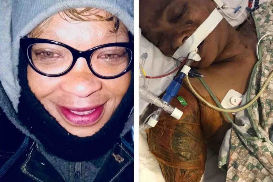 Links: Terri Cosby vor der Attacke - (rechts) Im Krankenhaus.
