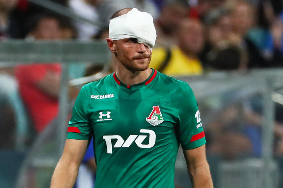 Gegen den FC Sochi verletzte sich Höwedes am Wochenende am Kopf, musste zehn Minuten vor Schluss ausgewechselt werden. Sein Einsatz am Mittwoch ist daher noch mit dem ein oder anderen Fragezeichen versehen.