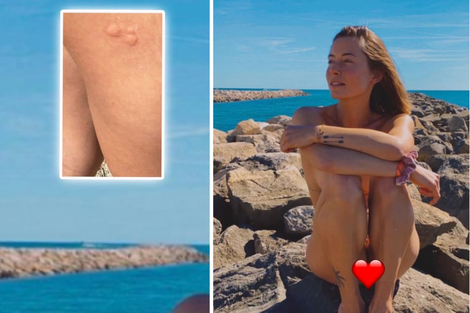 Jennifer Lange zeigte dieses Foto freizügig ohne Herz bei Instagram. Sie trägt ein Bikini-Höschen, wie sie angab. Am Oberschenkel wurde sie gestochen.