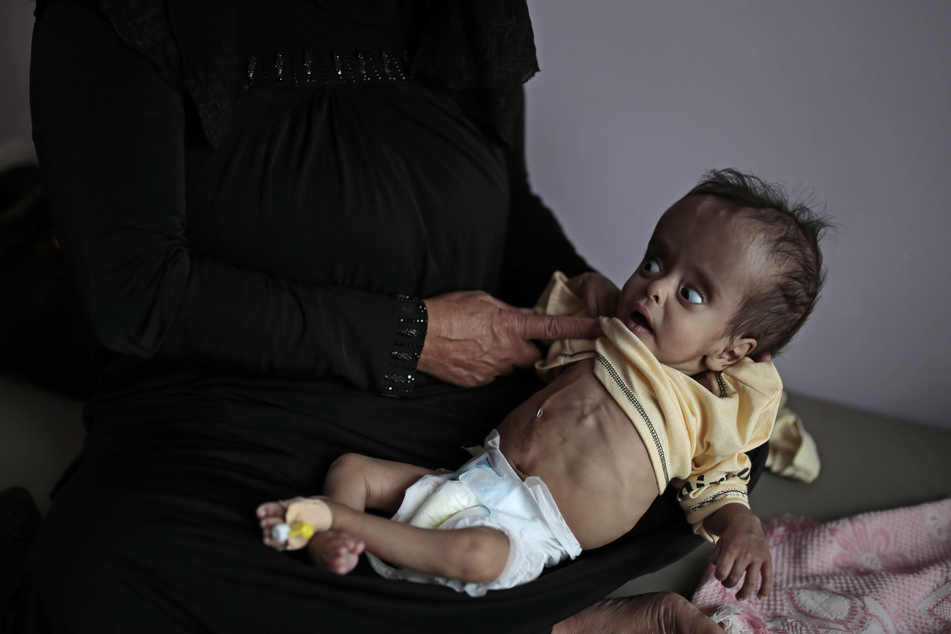 Eine Frau hält ihren unterernährten Jungen im Al Sabeen Krankenhaus in Sanaa, der Hauptstadt Jemens, im Arm. (Archivbild)