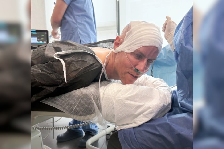 Beauty-Experte Jens Hilbert (48) während seiner Haartransplantation.
