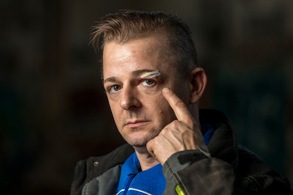 Direktor Sascha Köllner (39) wurde von den Angreifern am Kopf verletzt.