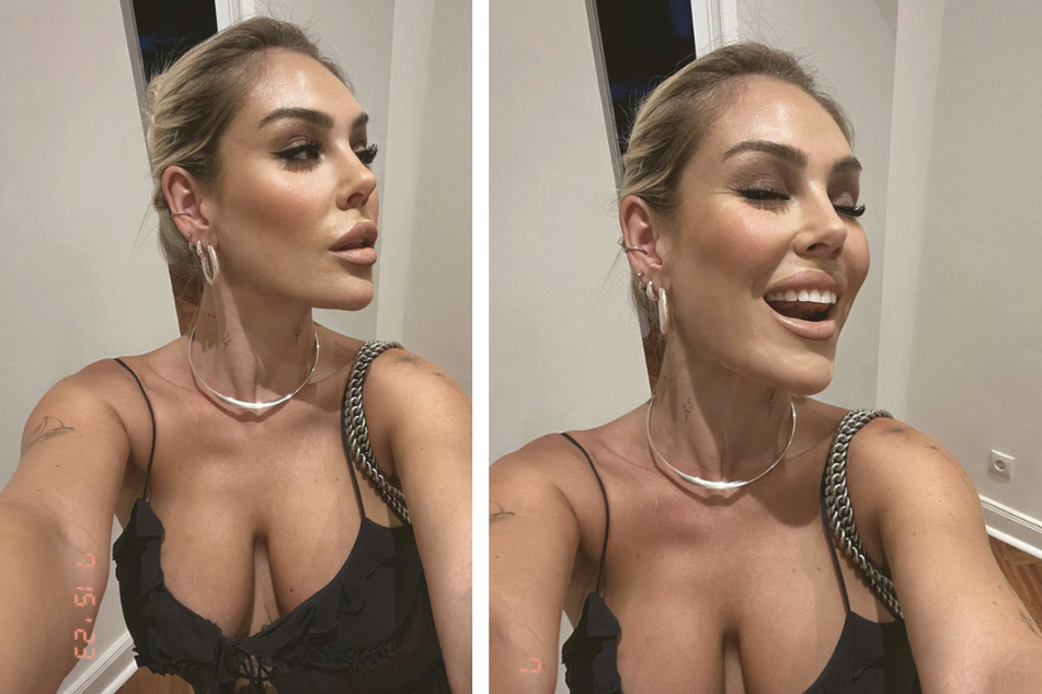 Die Influencerin beteuert: Sie hat an ihrem Gesicht nichts mehr machen lassen.