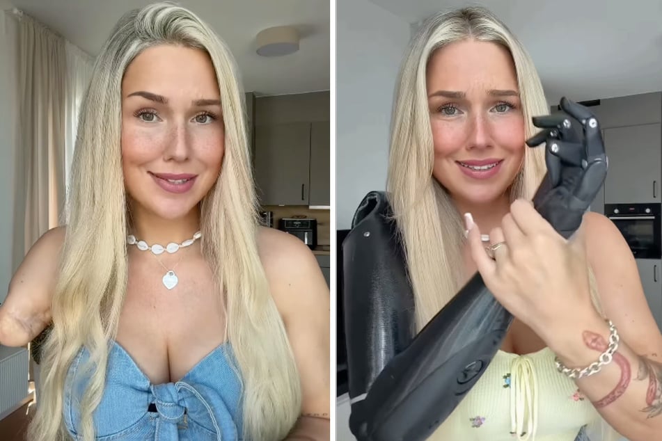 In den sozialen Netzwerken gewährt die ehemalige "Miss Germany"-Finalistin seit Jahren ehrliche Einblicke in ihr Leben mit Handicap.