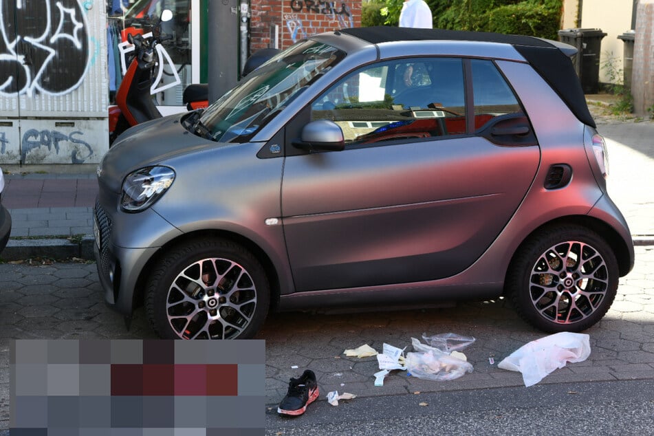 Bei einem Unfall in Hamburg-Eppendorf hat ein älterer Mann einen Fuß verloren.