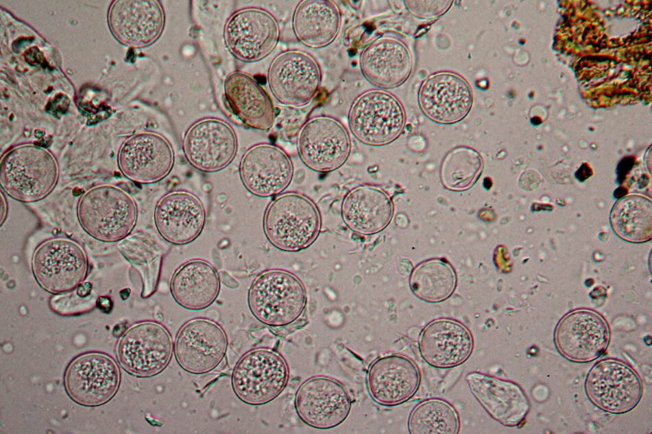 Gräserpollenkörner unter dem Lichtmikroskop. Die Allergie-Saison könnte laut Forschern der Technischen Universität München (TUM) auch durch Pollen von mehreren Hundert Kilometer entfernt blühenden Pflanzen verlängert werden.