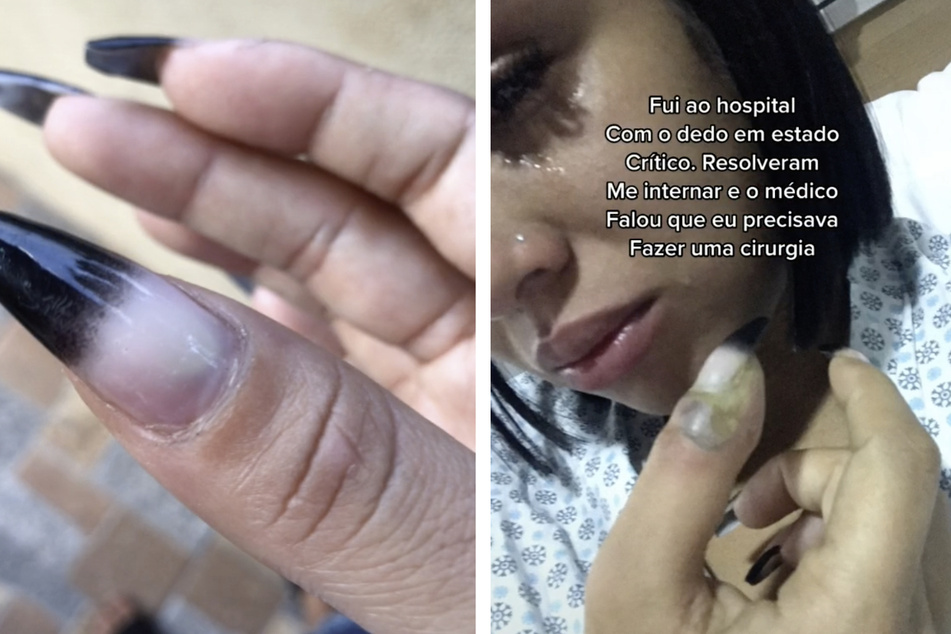 Jenneffer präsentierte ihren entzündeten Nagel auf TikTok.