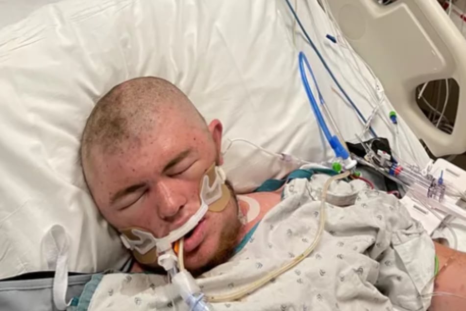 Austin Bellamy (20) was put in a medically induced coma after getting stung 20,000 times by bees.