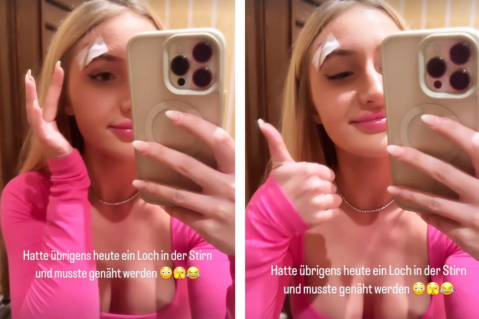 Die 24-jährige Frankfurterin meldete sich am Freitagabend mit einer Instagram-Story bei ihren Fans, sie berichtete von einem "Loch in der Stirn".
