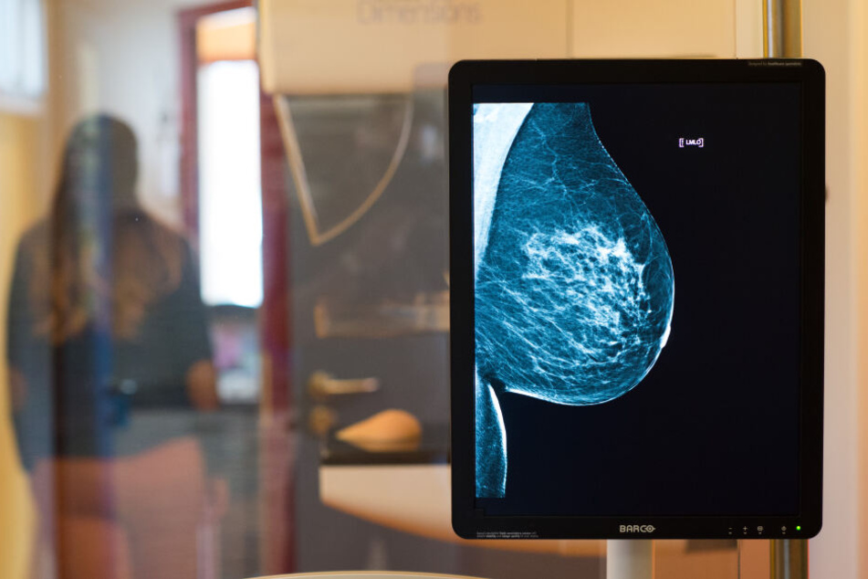Mammographie-Screenings und ihre Ergebnisse sind nur für die Augen der Patientin und ihres Arztes gedacht. (Symbolbild)