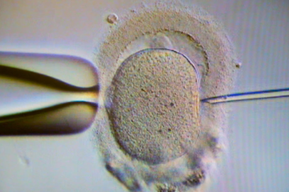 Bei der künstlichen Befruchtung soll der Vater schon von der Mutter getrennt gewesen sein (Symbolfoto).