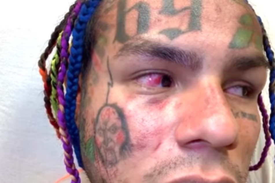 Auf Instagram teilte 6ix9ine (26) Bilder von sich nach der Attacke.