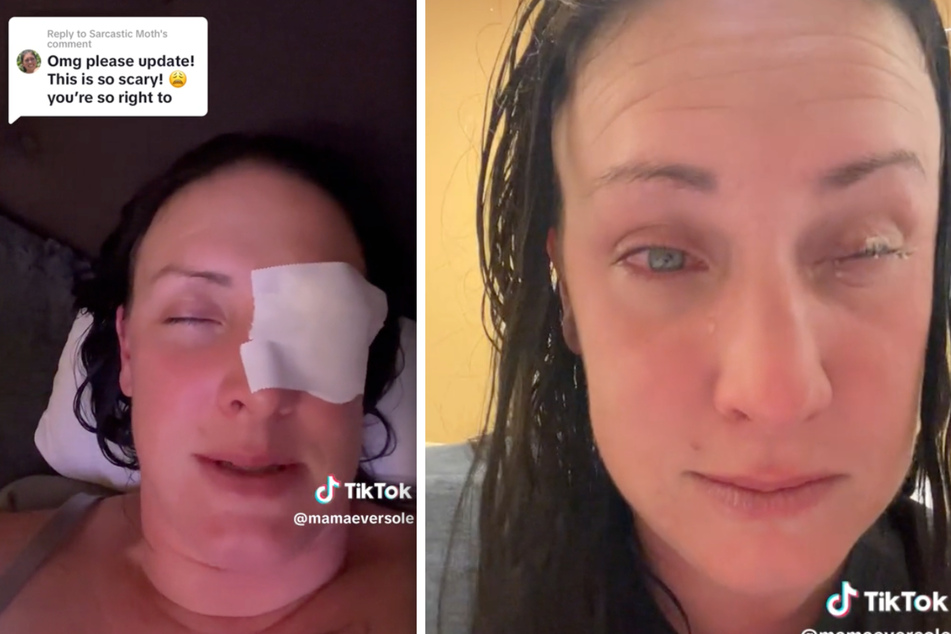 Jennifer Eversole wollte Augentropfen benutzen, doch sie griff nach dem falschen Fläschchen. Als sie realisierte, dass es Nagelleim war, brannte ihr Auge bereits.