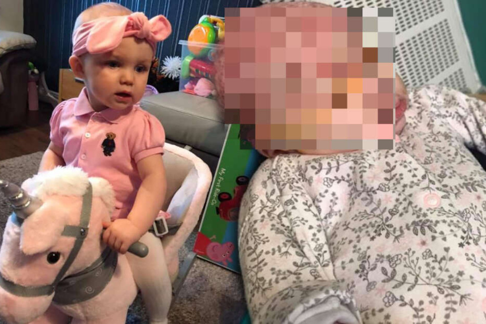 Weil Mutter ihr Baby küsst: Viruserkrankung lässt Säugling beinahe erblinden!