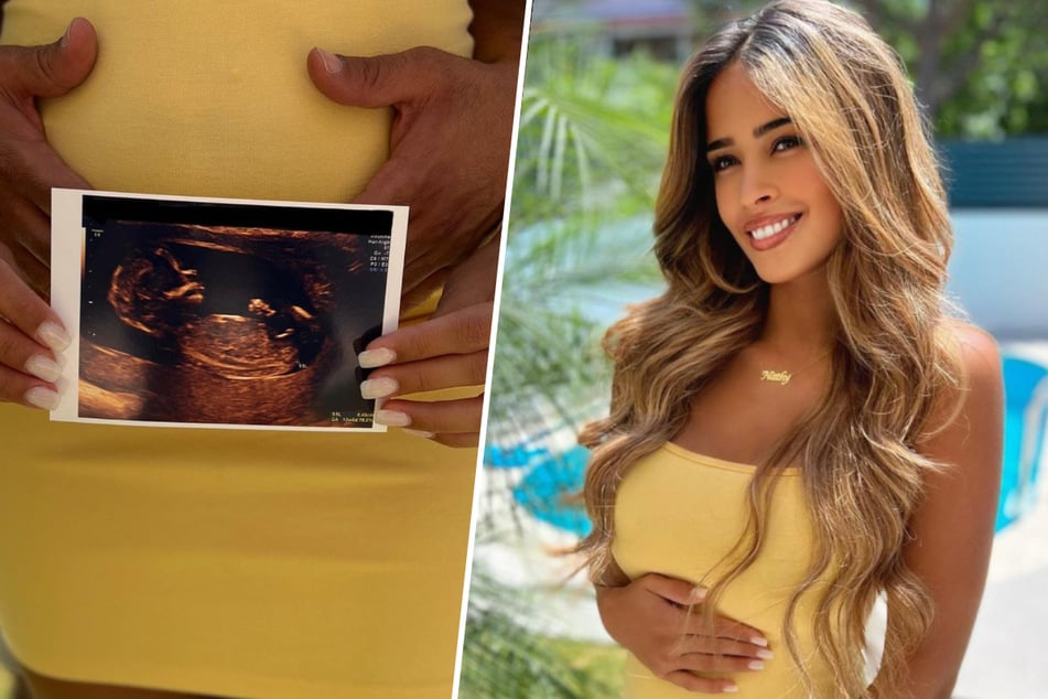 Auf Instagram postet Nathália Gonçalves Miranda (29) zahlreiche Updates zu ihrer Schwangerschaft.