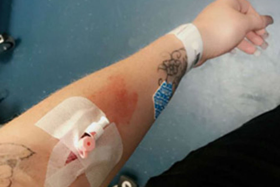 Am Dienstag musste die 21-Jährige ins Krankenhaus gebracht werden. Eine Schönheits-OP lief wohl nicht so gut, wie geplant. Auf Snapchat veröffentlichte sie mehrere Fotos von ihrem Klinikaufenthalt.
