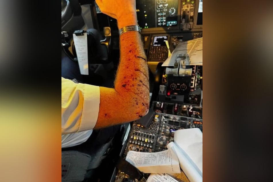 Auch der Pilot trug offenbar Verletzungen davon.